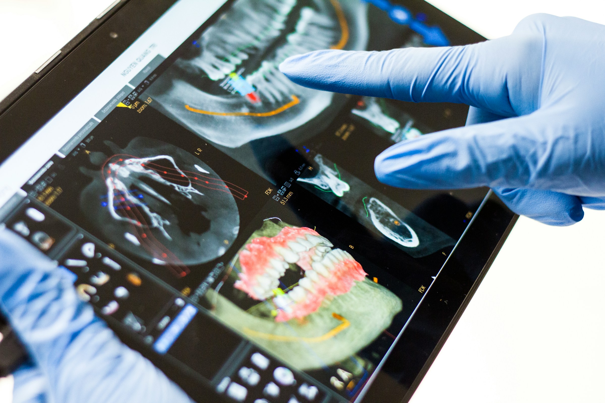 Reviewing CBCT planning data on tablet