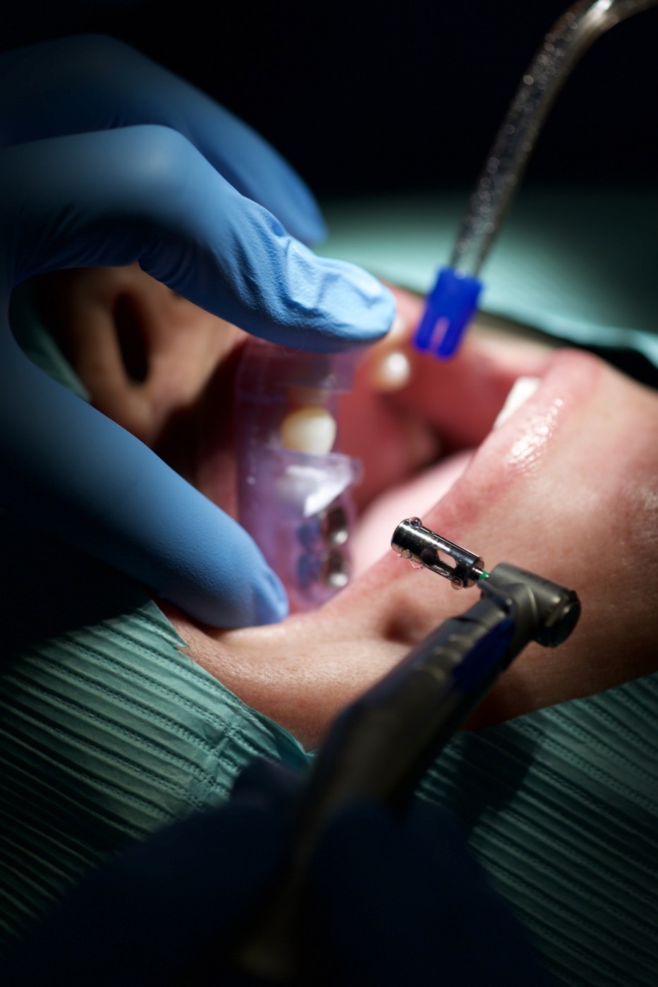 Digital dentistry case planning on screen