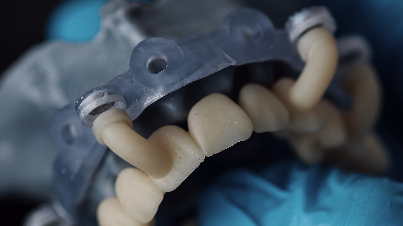 A printed surgical guide over the arch it was designed for