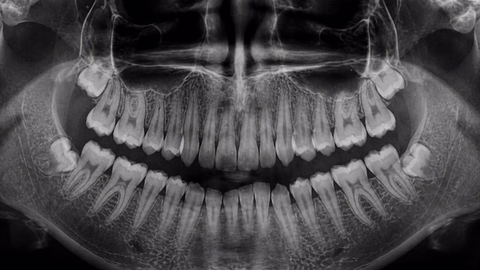 A panoramic radiograph