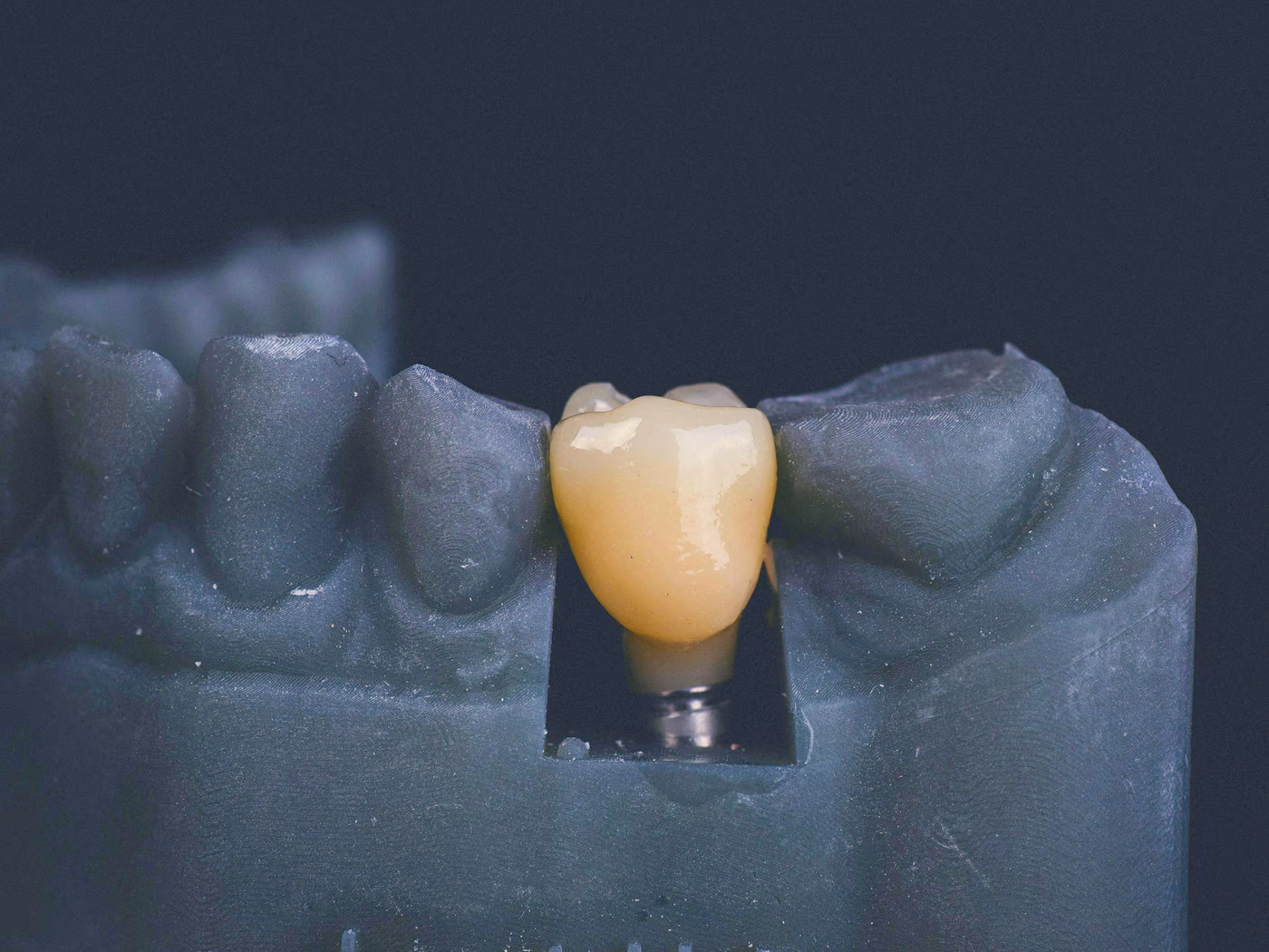 A designed crown seated on the printed model it was built for