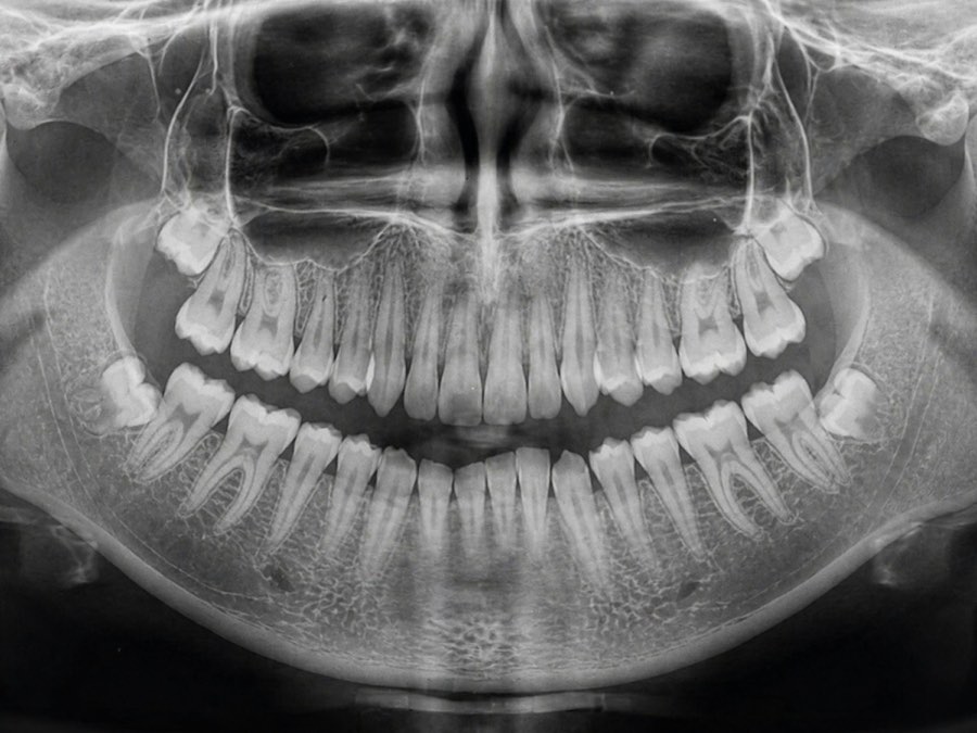 A panoramic radiograph, the kind of record a case arrives with