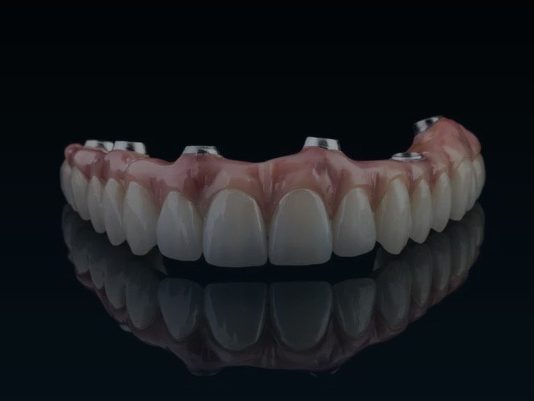Finished full-arch zirconia hybrid prosthesis with pink gingiva